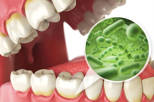 How to cure gum disease without a dentist. Learn about home remedies, lifestyle changes, and dental products to improve your gum health.